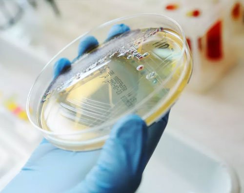 parasitologie-casablanca-laboratoire